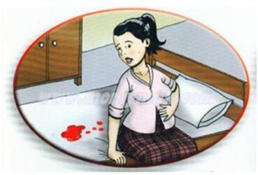 Obat Pendarahan Rahim