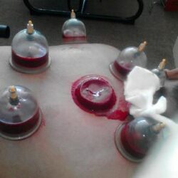 Pengobatan dan Urut Tradisional Rini Sehat